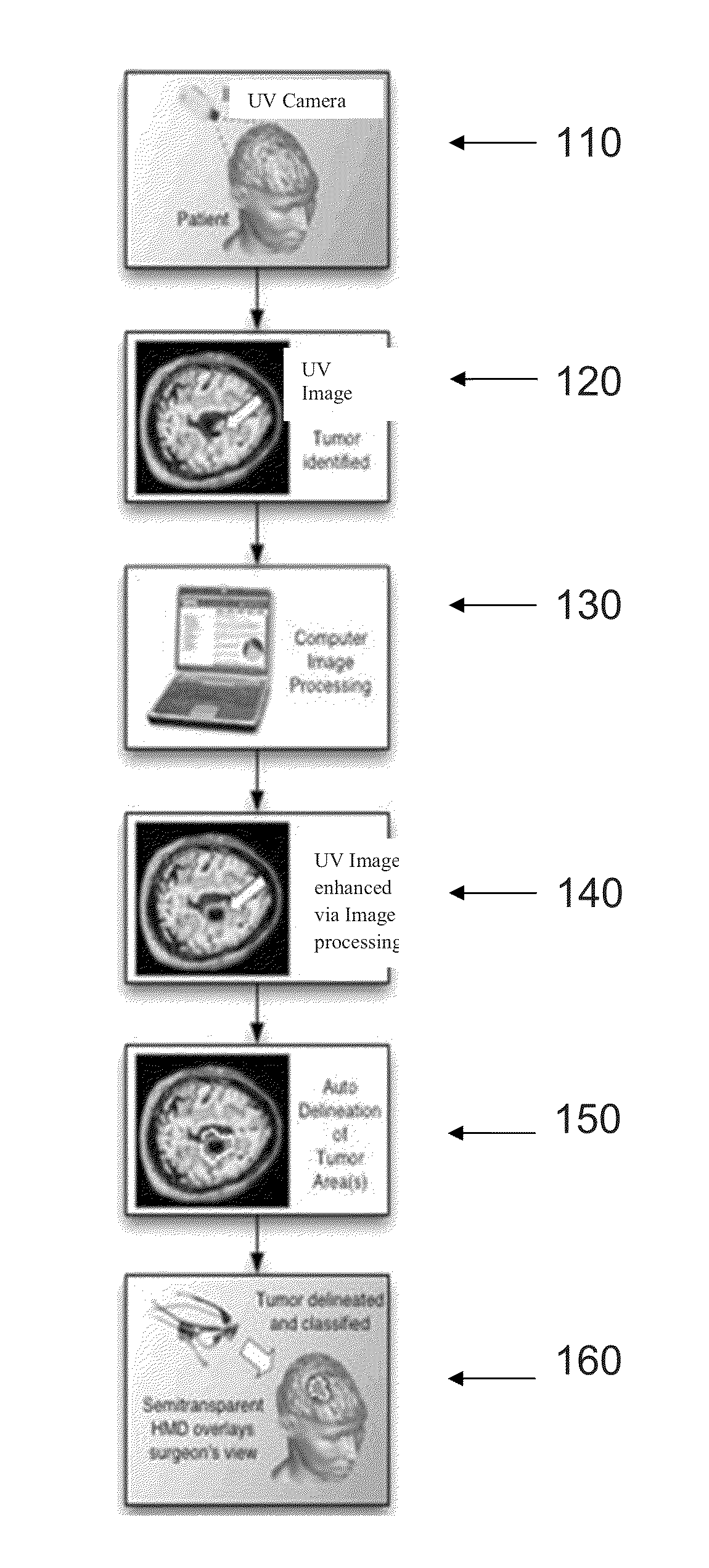 UV imaging for intraoperative tumor delineation