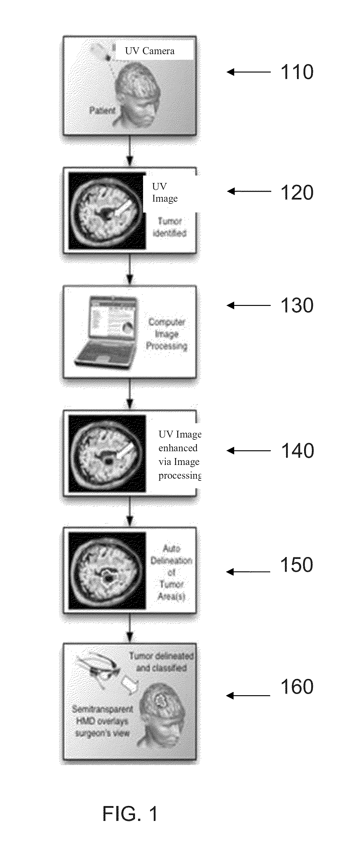 UV imaging for intraoperative tumor delineation