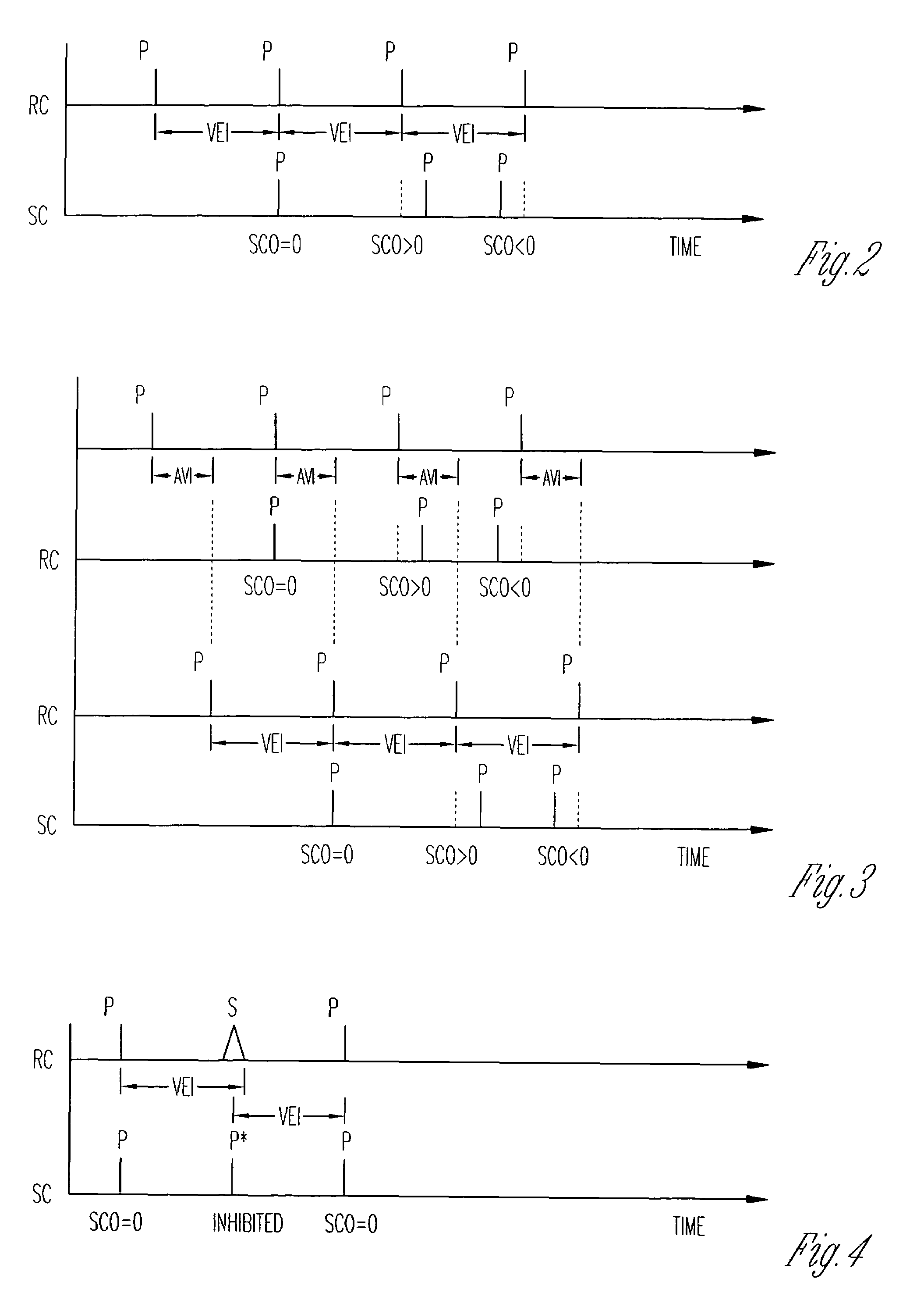 System and method for cardiac rhythm management with synchronized pacing protection period