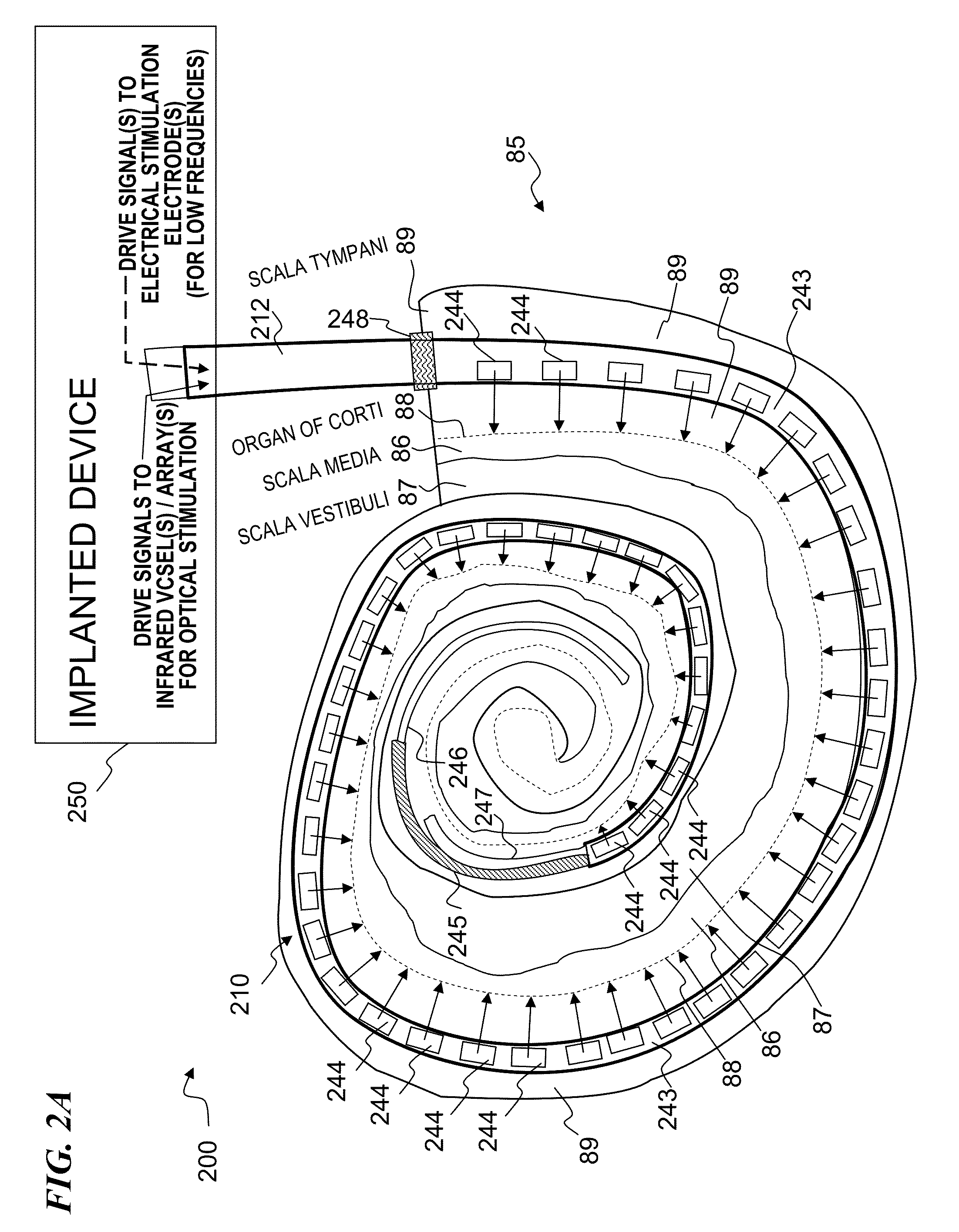 Optical-stimulation cochlear implant with electrode(s) at the apical end for electrical stimulation of apical spiral ganglion cells of the cochlea