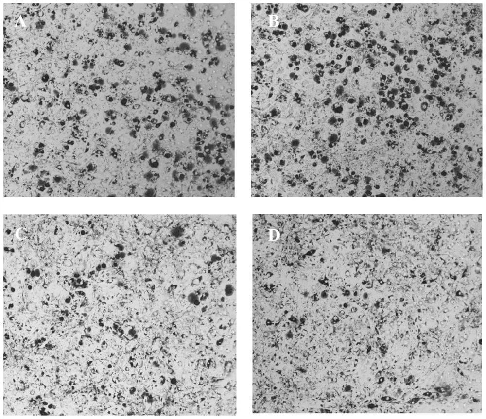 Bifidobacterium longum MF-269 and application thereof