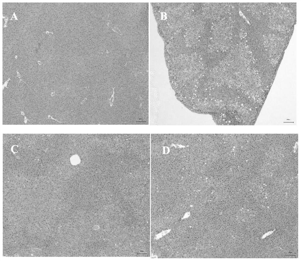 Bifidobacterium longum MF-269 and application thereof