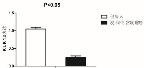 Application of klk13 in the preparation of a detection kit for diagnosing cervical adenocarcinoma