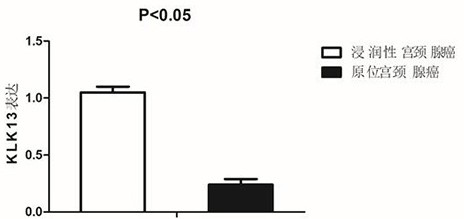 Application of klk13 in the preparation of a detection kit for diagnosing cervical adenocarcinoma