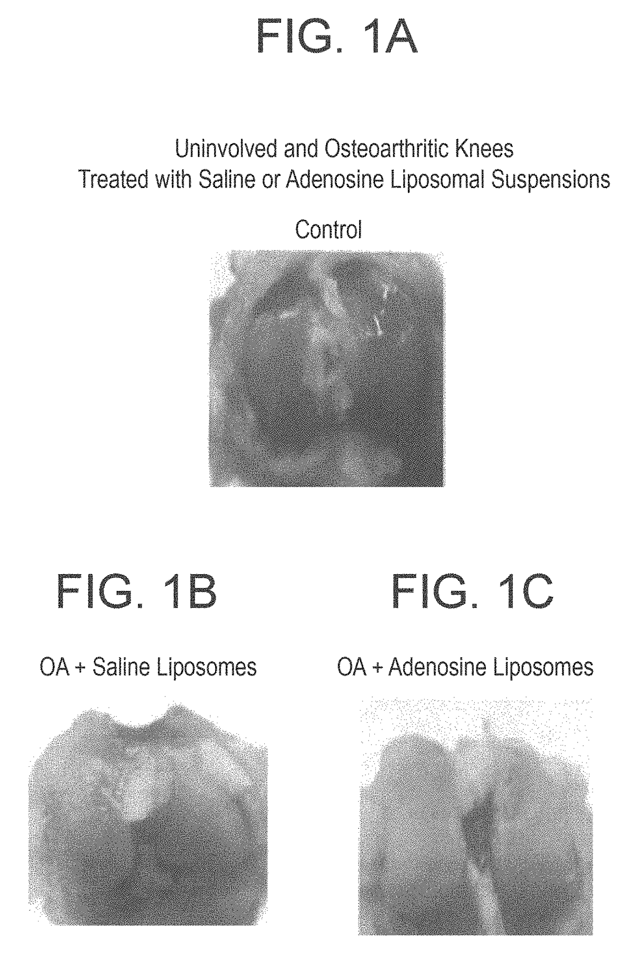 Methods and compositions for treating osteoarthritis and promoting cartilage formation