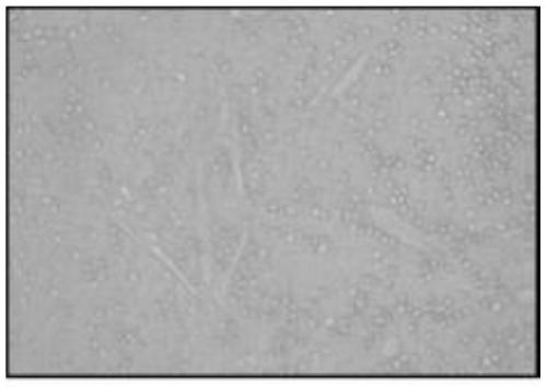 Stem cell factor microvesicle preparation coming from human umbilical cord mesenchymal stem cells and preparation method thereof