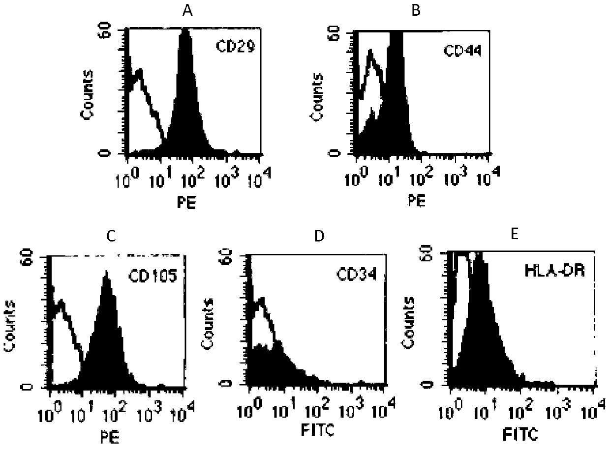 Stem cell factor microvesicle preparation coming from human umbilical cord mesenchymal stem cells and preparation method thereof