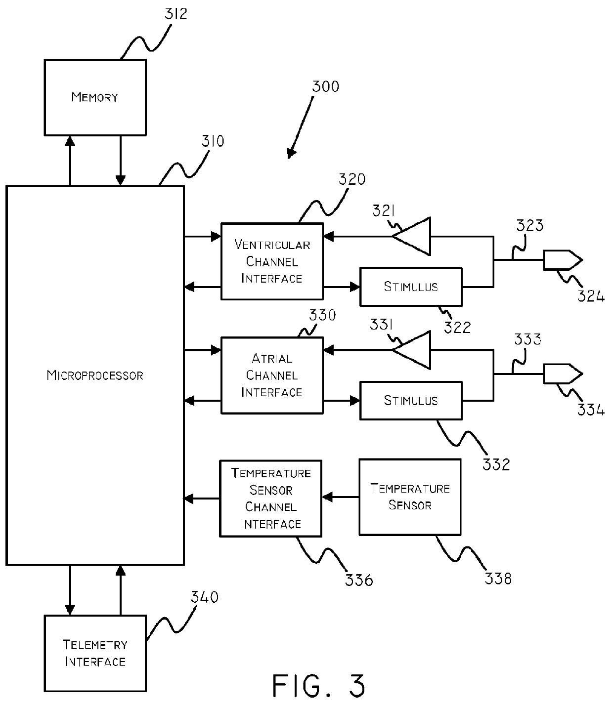 Temperature based systems and methods for tachycardia discrimination and therapy