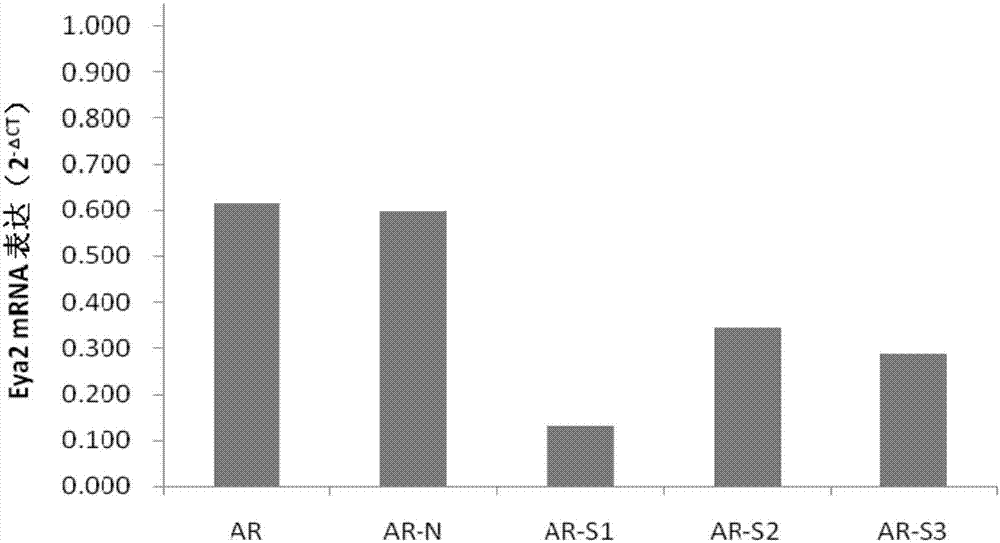 siRNA capable of specifically inhibiting expression of Eya2 gene as well as recombinant vector and application of siRNA