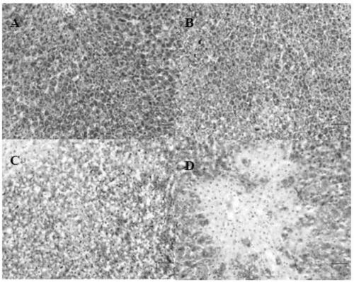 Hepatoprotective space Lactobacillus plantarum FH-SS18-86365L and application thereof