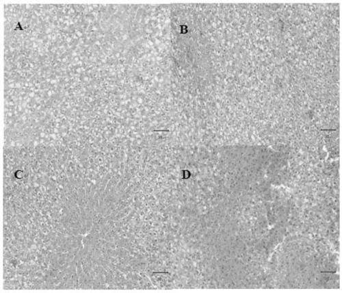 Hepatoprotective space Lactobacillus plantarum FH-SS18-86365L and application thereof