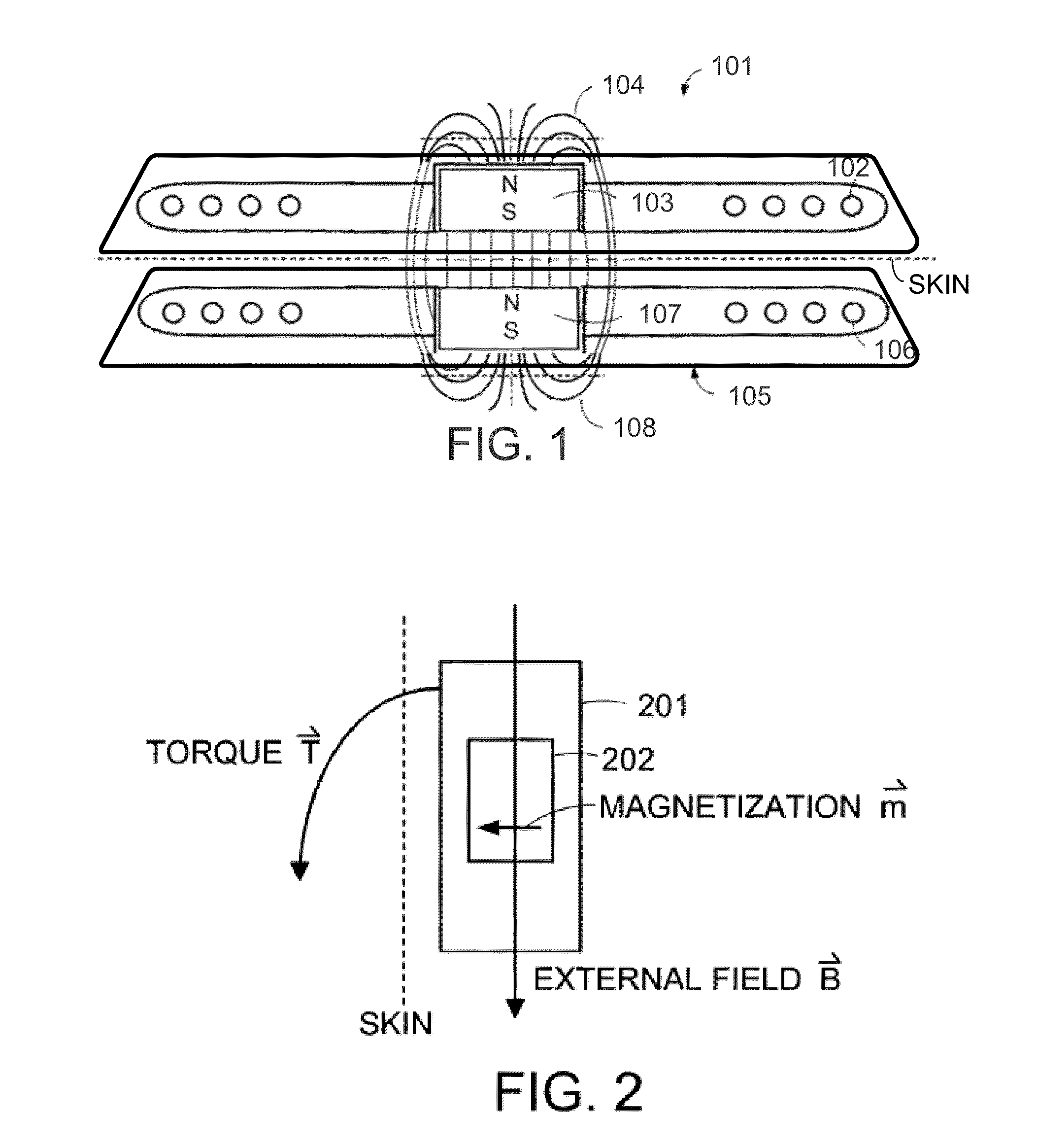 MRI-Safe Implant Magnet with Angular Magnetization