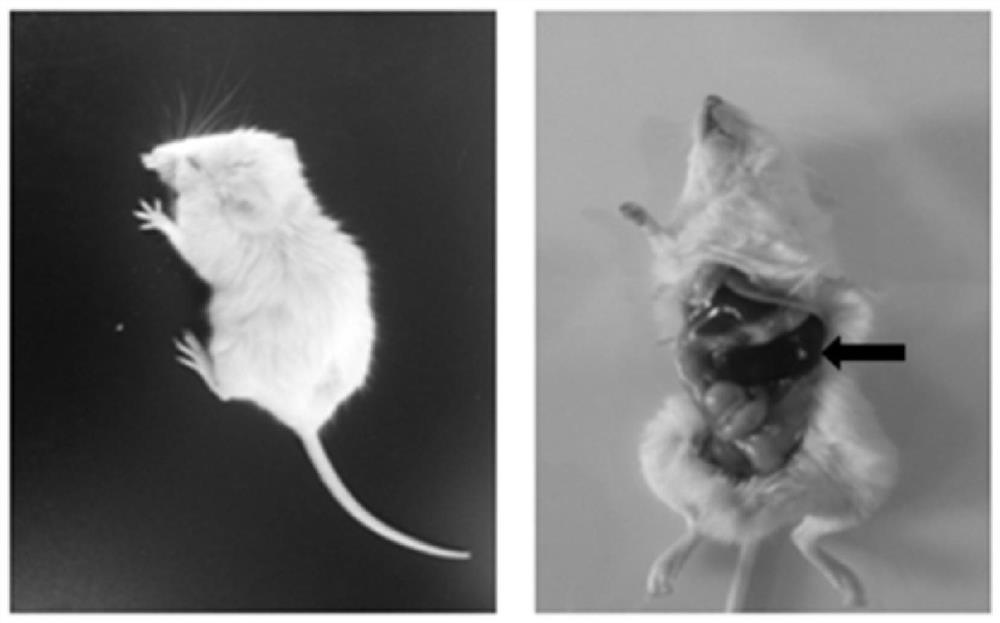 A method for establishing human hematological tumor pdx model