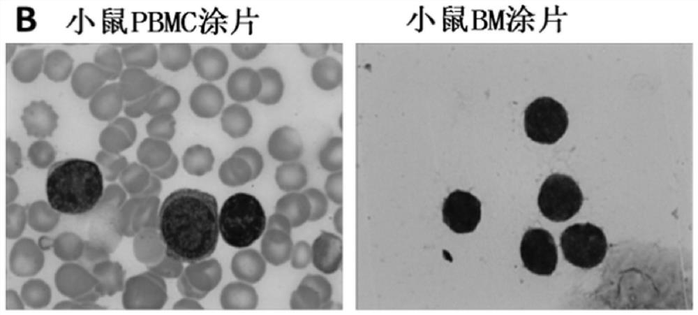 A method for establishing human hematological tumor pdx model