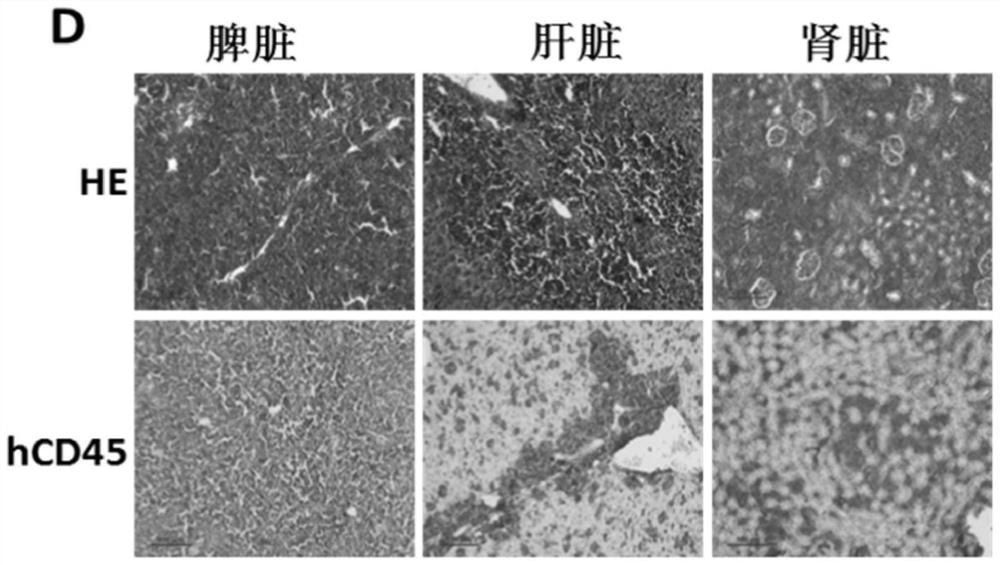 A method for establishing human hematological tumor pdx model