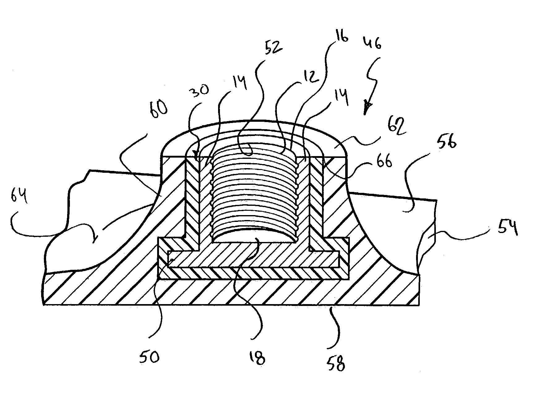 Method of making part having insert assembly