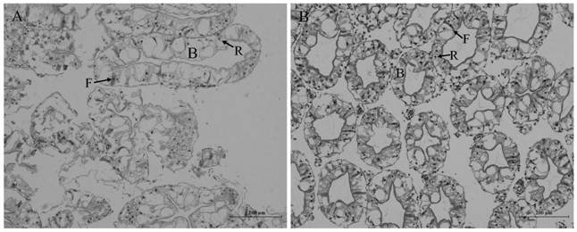 Preparation method of healthy feed additive for protecting hepatopancreas of procambarus clarkii