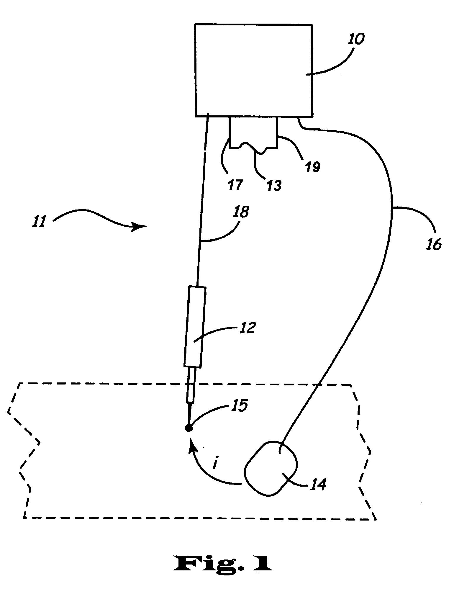 Lead set for nerve stimulator and method of operation thereof