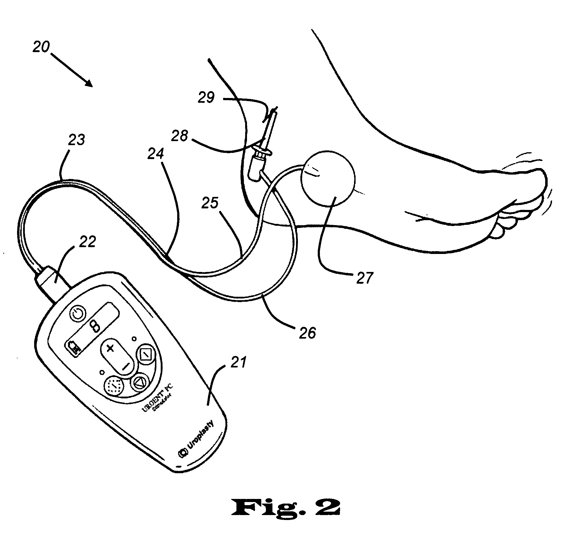 Lead set for nerve stimulator and method of operation thereof