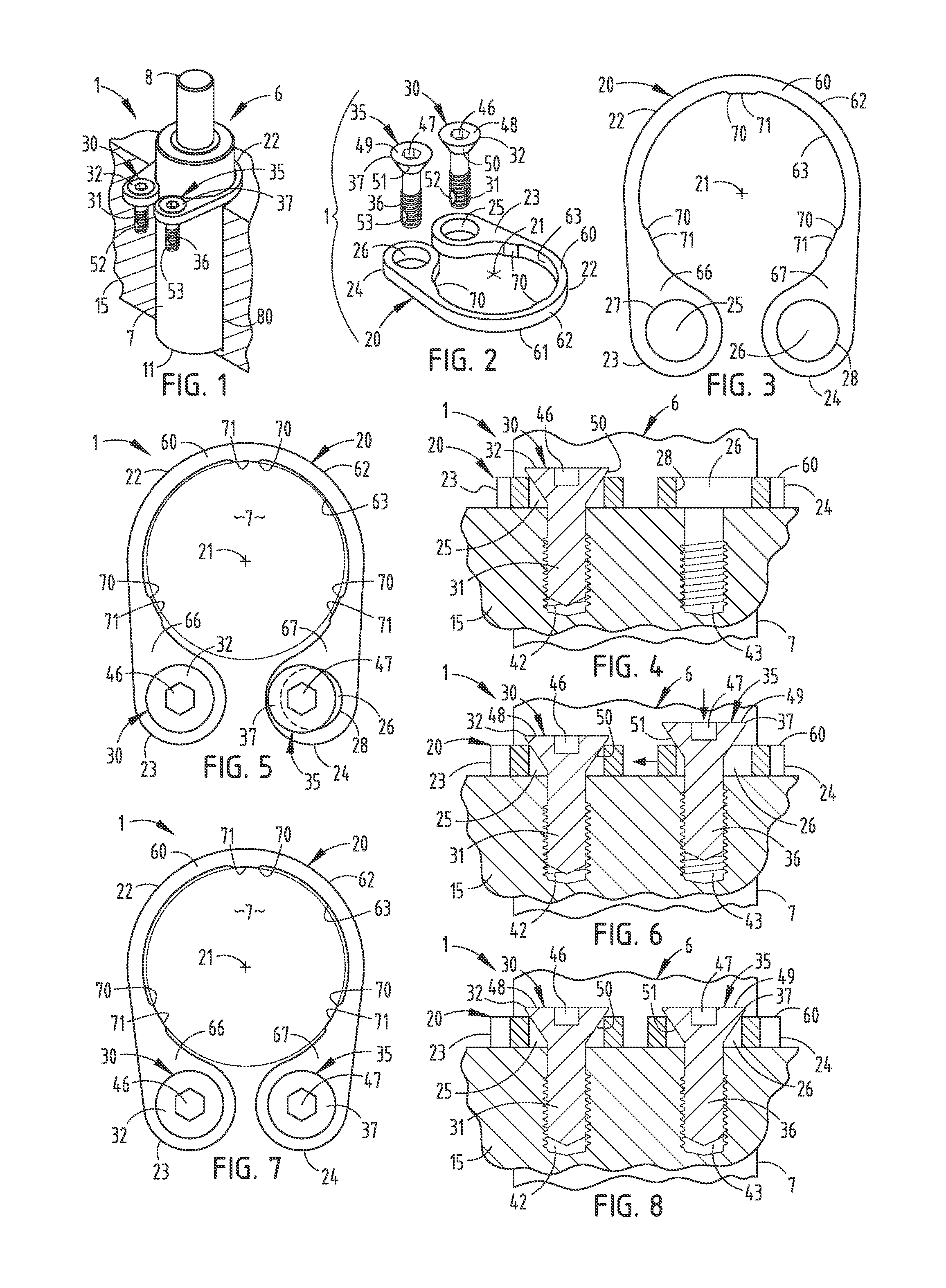 Gas spring mounting assembly and method for metal forming dies