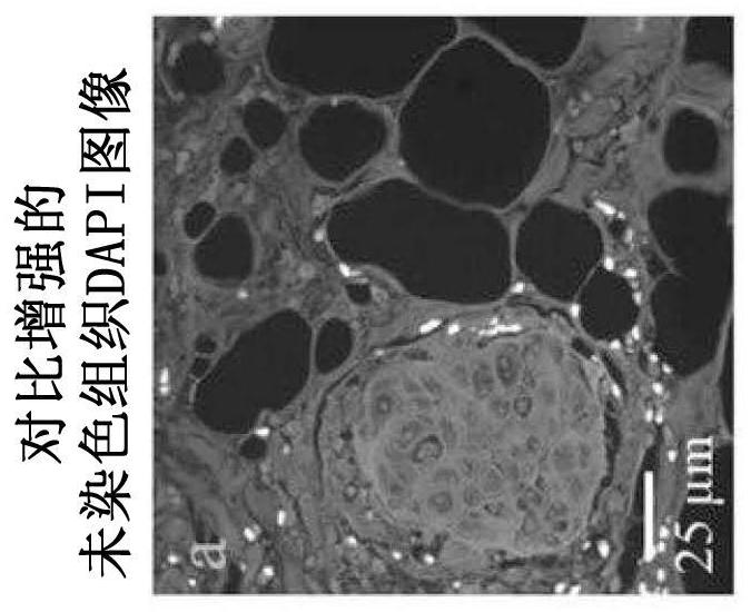 Method and system for digital staining of label-free fluorescence images using deep learning