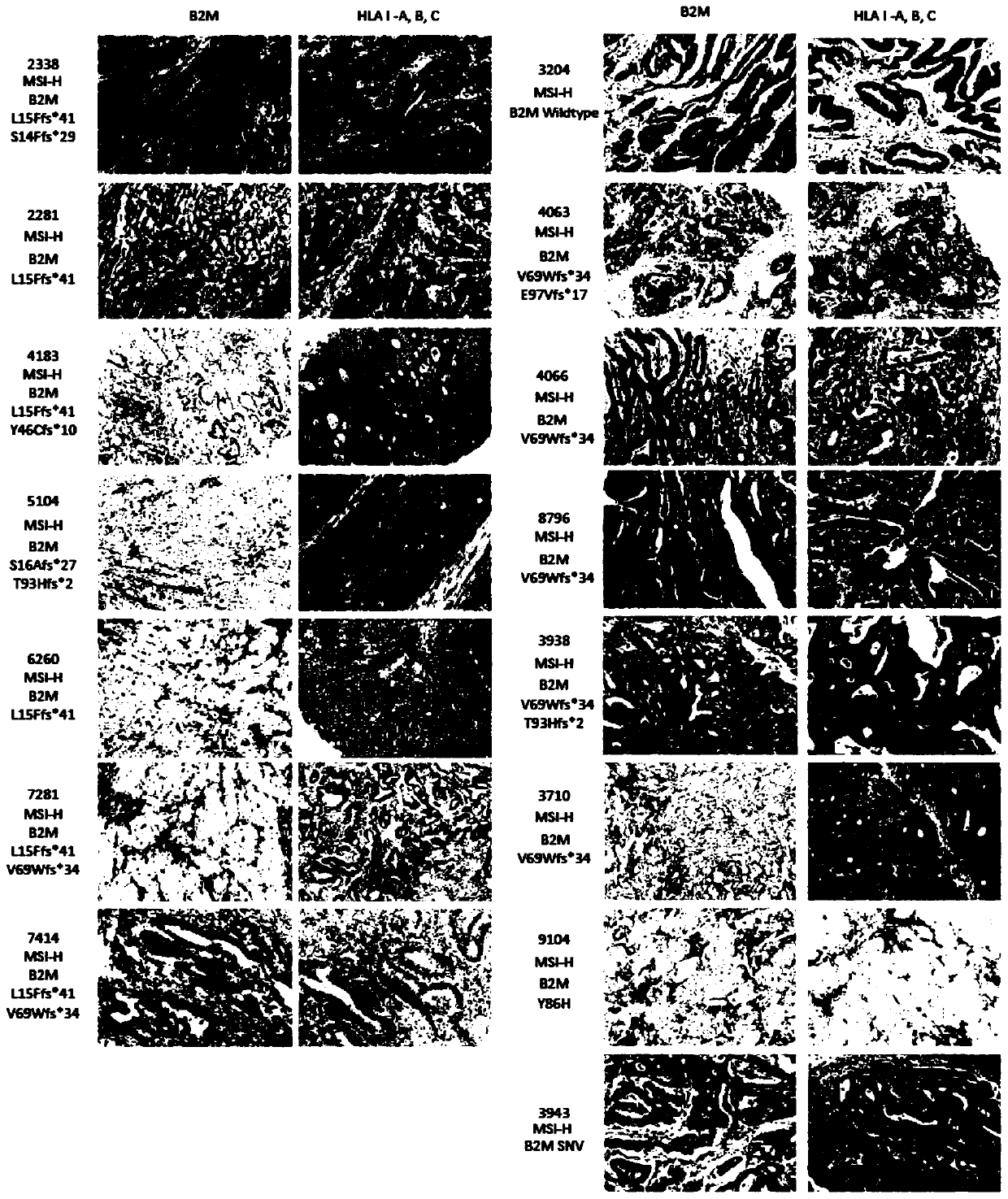 Immune sensitization predicted biomarker component, use and kit equipment storage medium