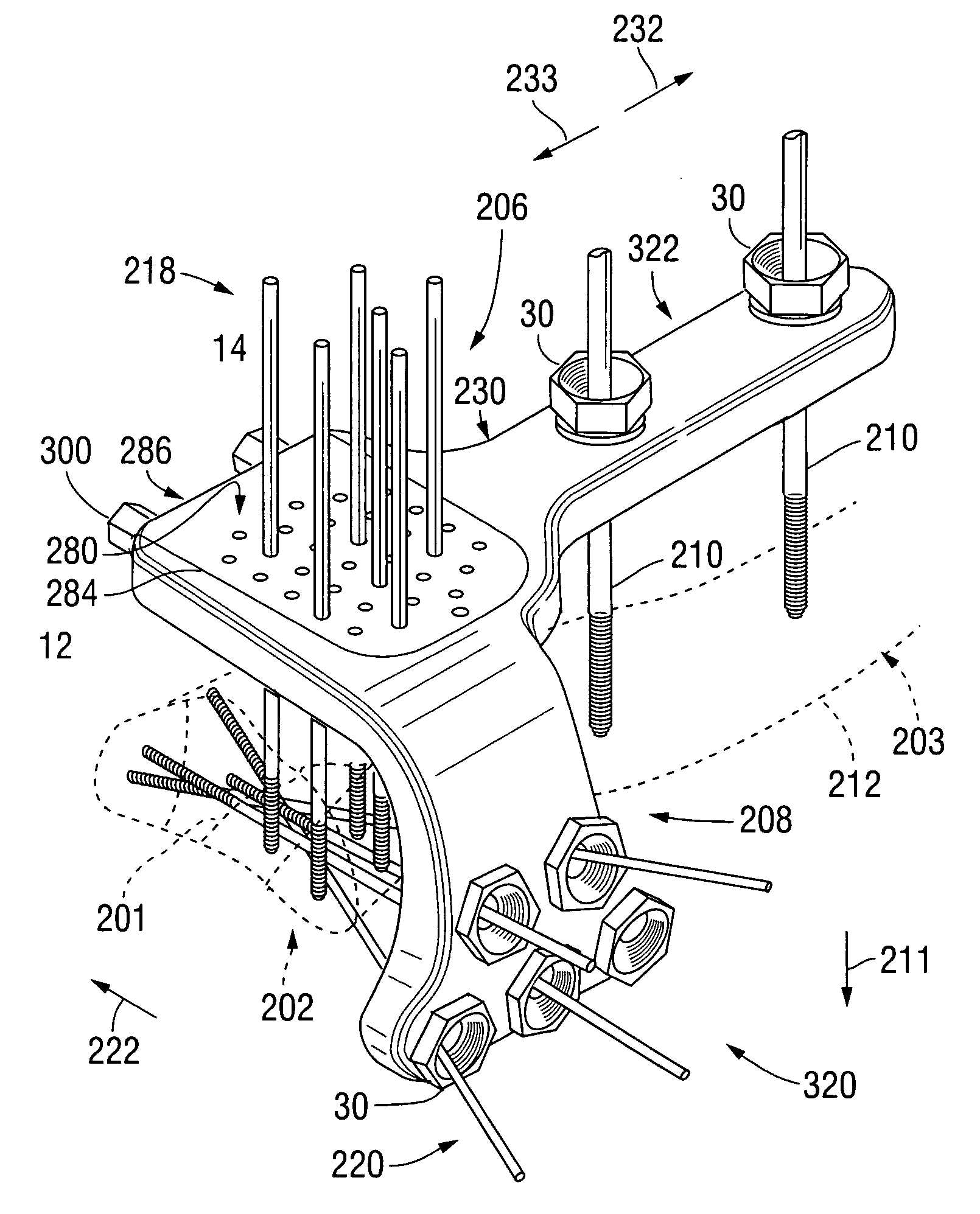 Apparatus for external fixation of a fractured distal radius with angularly adjustable pin clamping means