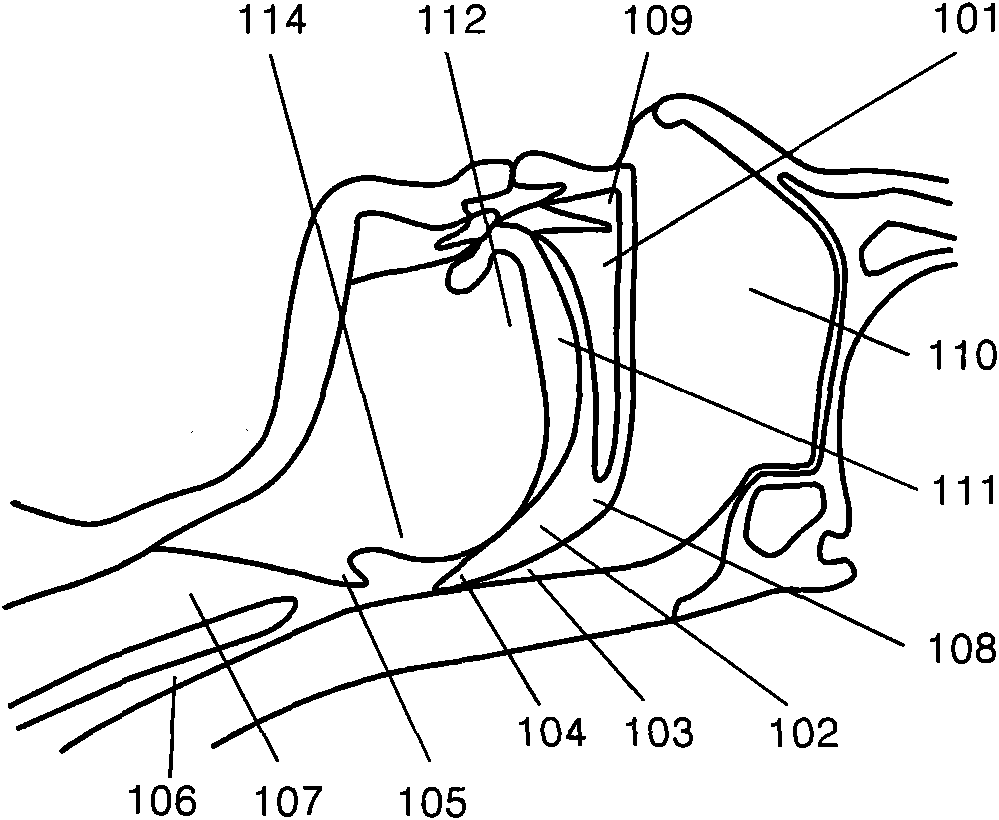 Adjustable soft palate supporting body