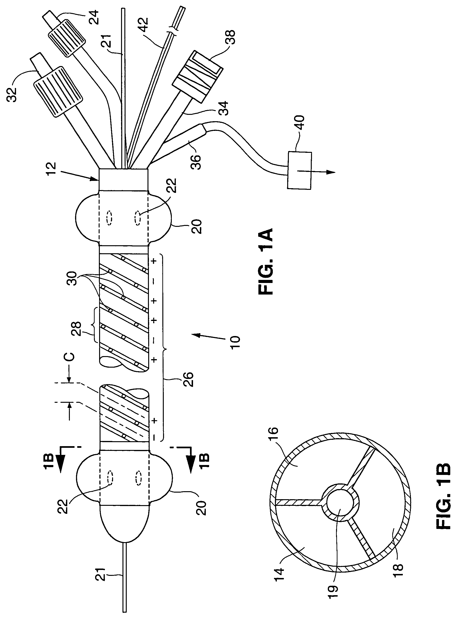 Apparatus and method for treating venous reflux