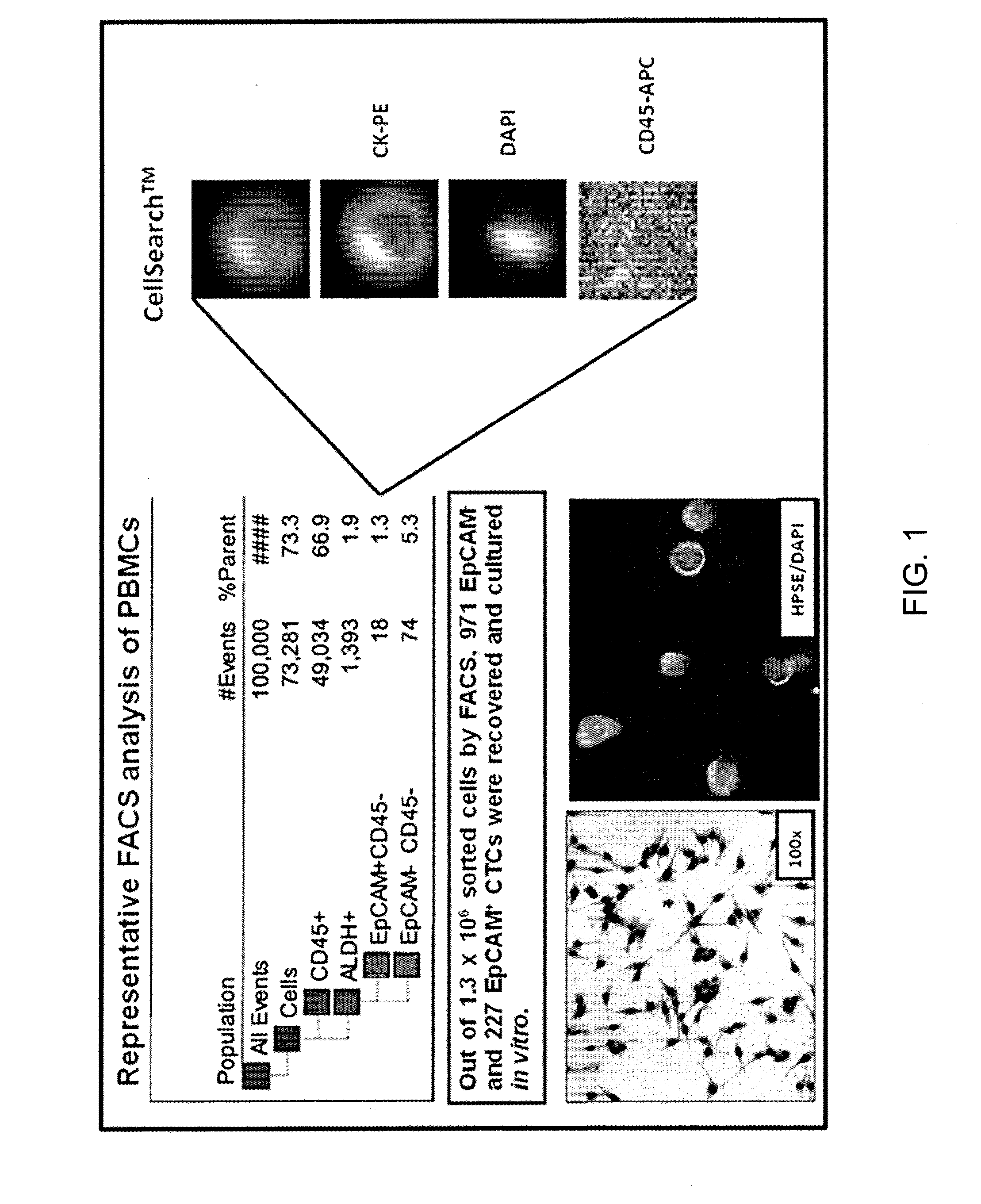 Ctc biomarker assay to combat breast cancer brain metastasis