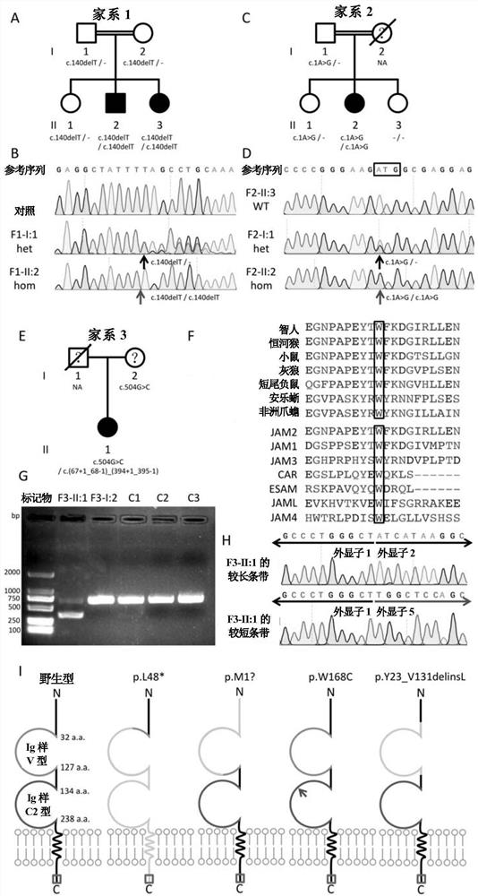 Primary familial cerebral calcification pathogenic gene jam2 and its application