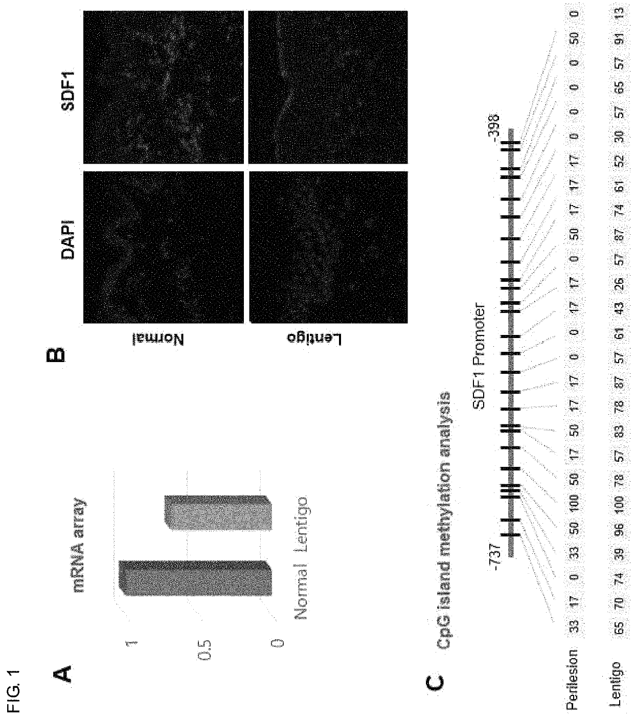 Composition for regulating cutaneous pigmentation or skin whitening comprising SDF1