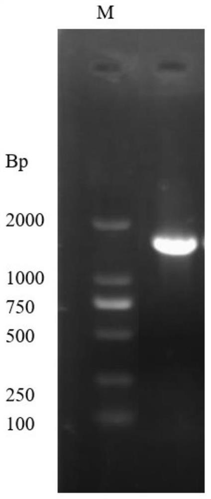 Lactobacillus plantarum capable of producing urate oxidase and inhibiting xanthine oxidase and application of lactobacillus plantarum