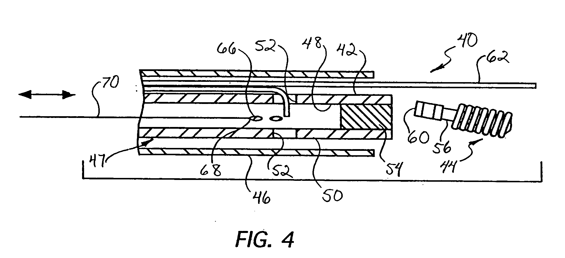 Intravascular device deployment mechanism incorporating mechanical detachment