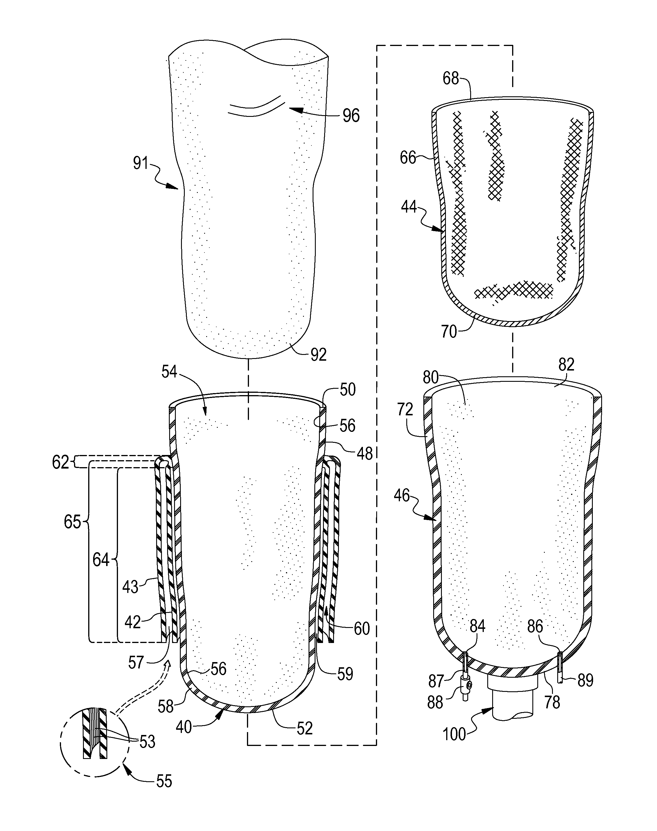 Vacuum assisted prosthetic sleeve and socket utilizing a double membrane liner