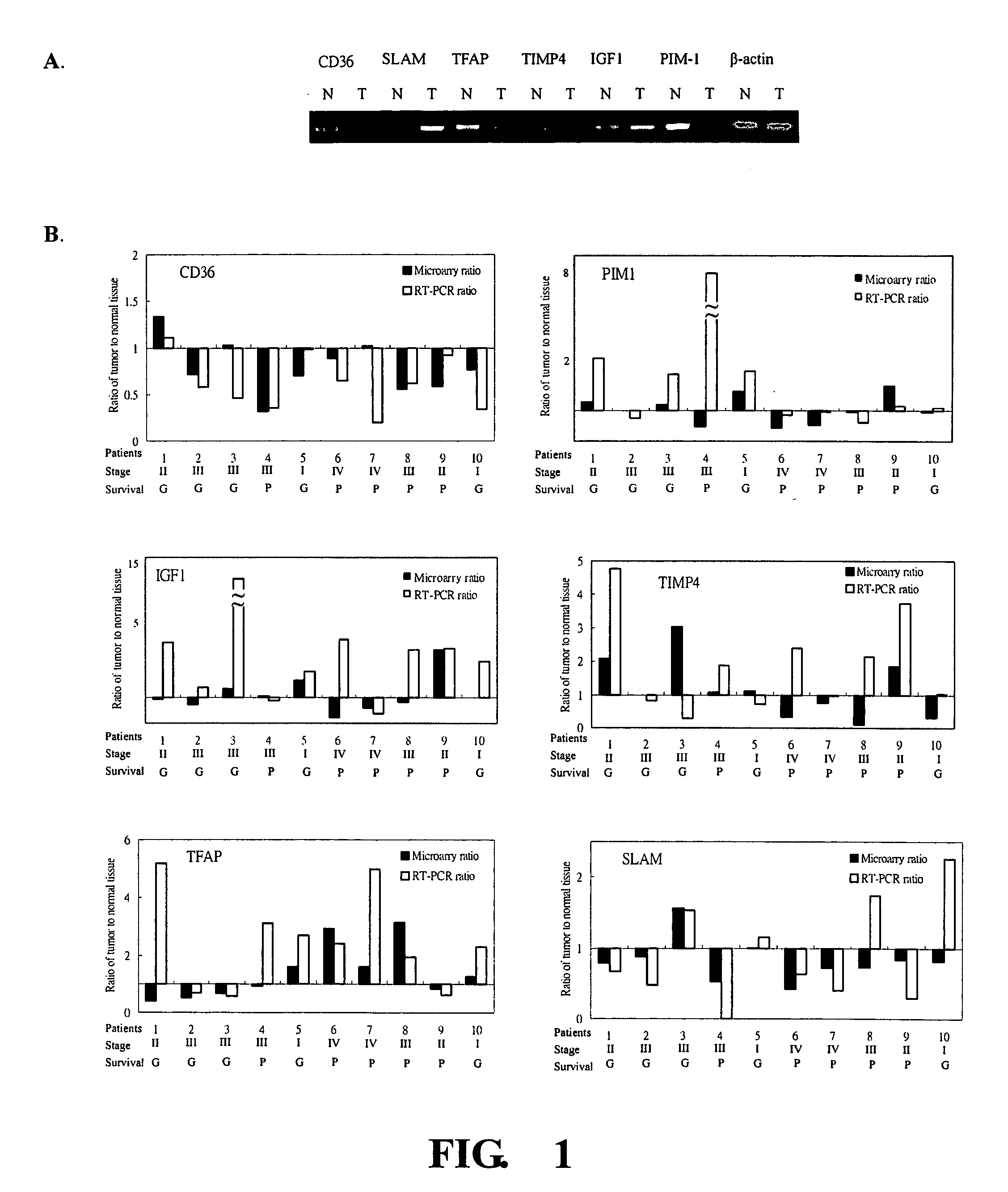 Method for survival prediction in gastric cancer patients after surgical operation using gene expression profiles and application thereof