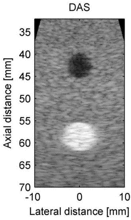 Method for self-adaptation ultrasonic imaging of spatio-temporally smoothed coherence factor type