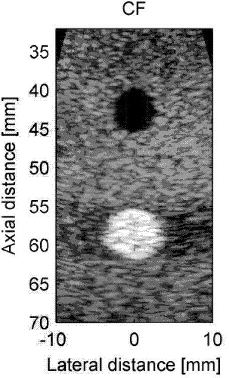 Method for self-adaptation ultrasonic imaging of spatio-temporally smoothed coherence factor type