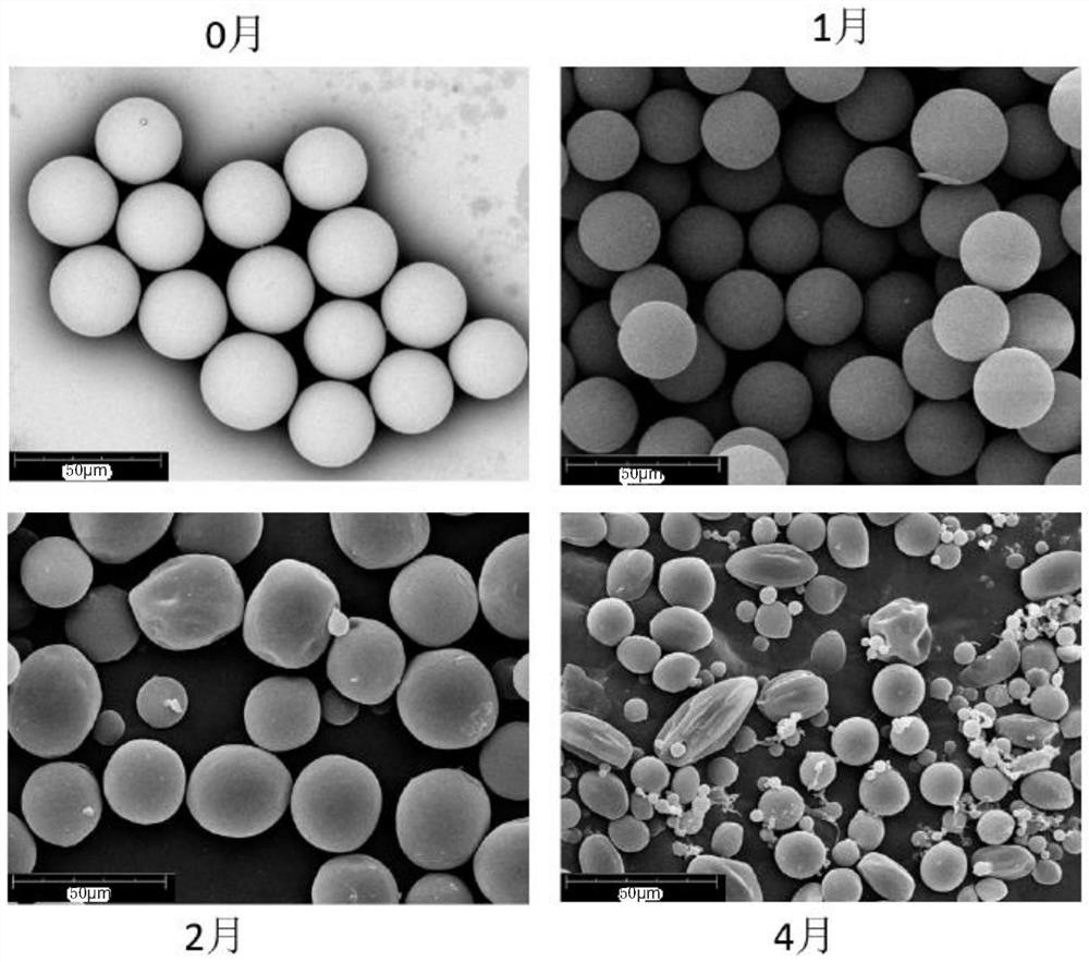 177Lu-loaded degradable polymer material microsphere as well as preparation method and application thereof