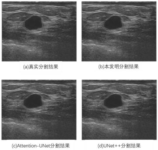 Breast ultrasound image tumor segmentation method