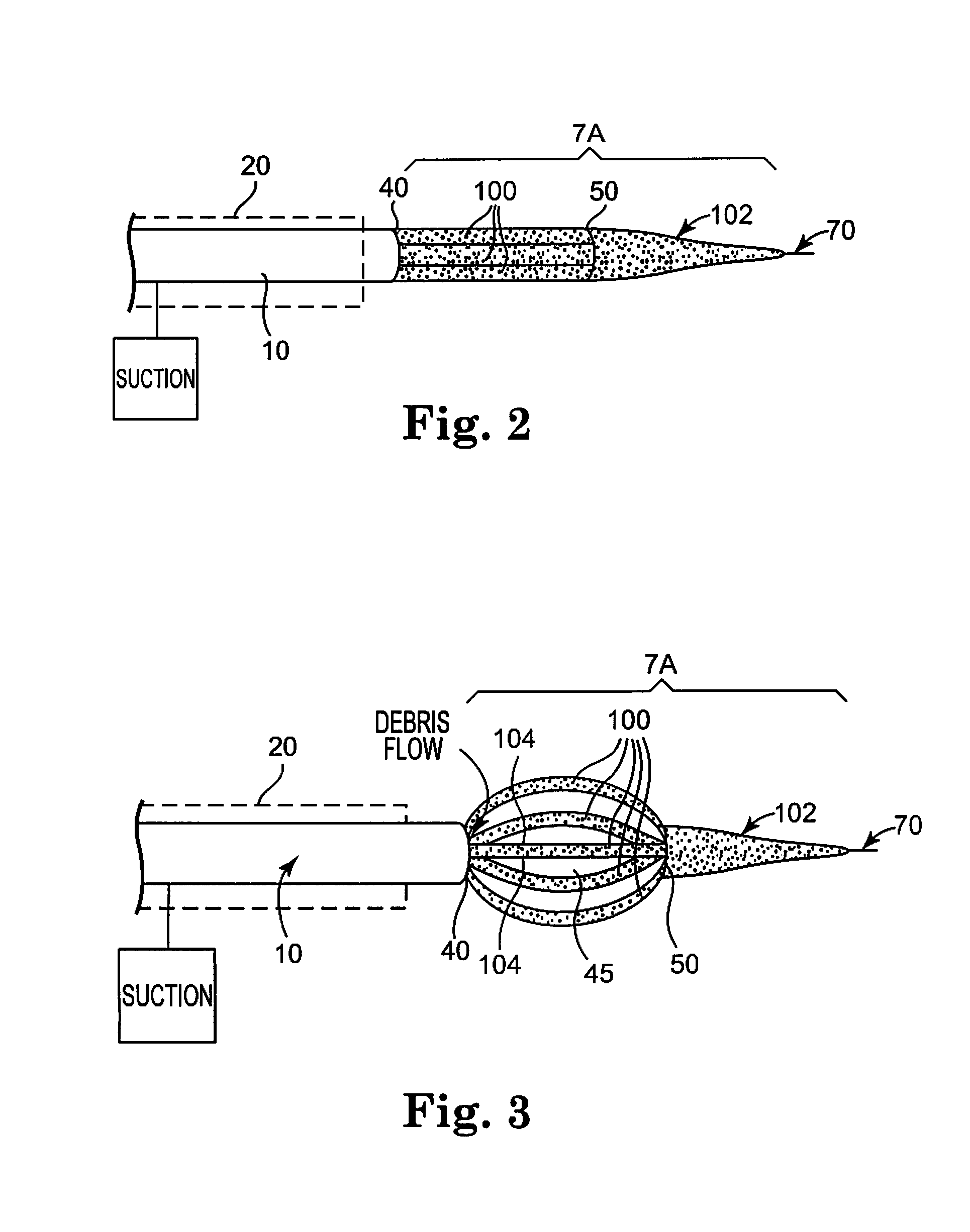 Abrasive nose cone with expandable cutting and sanding region for rotational atherectomy device