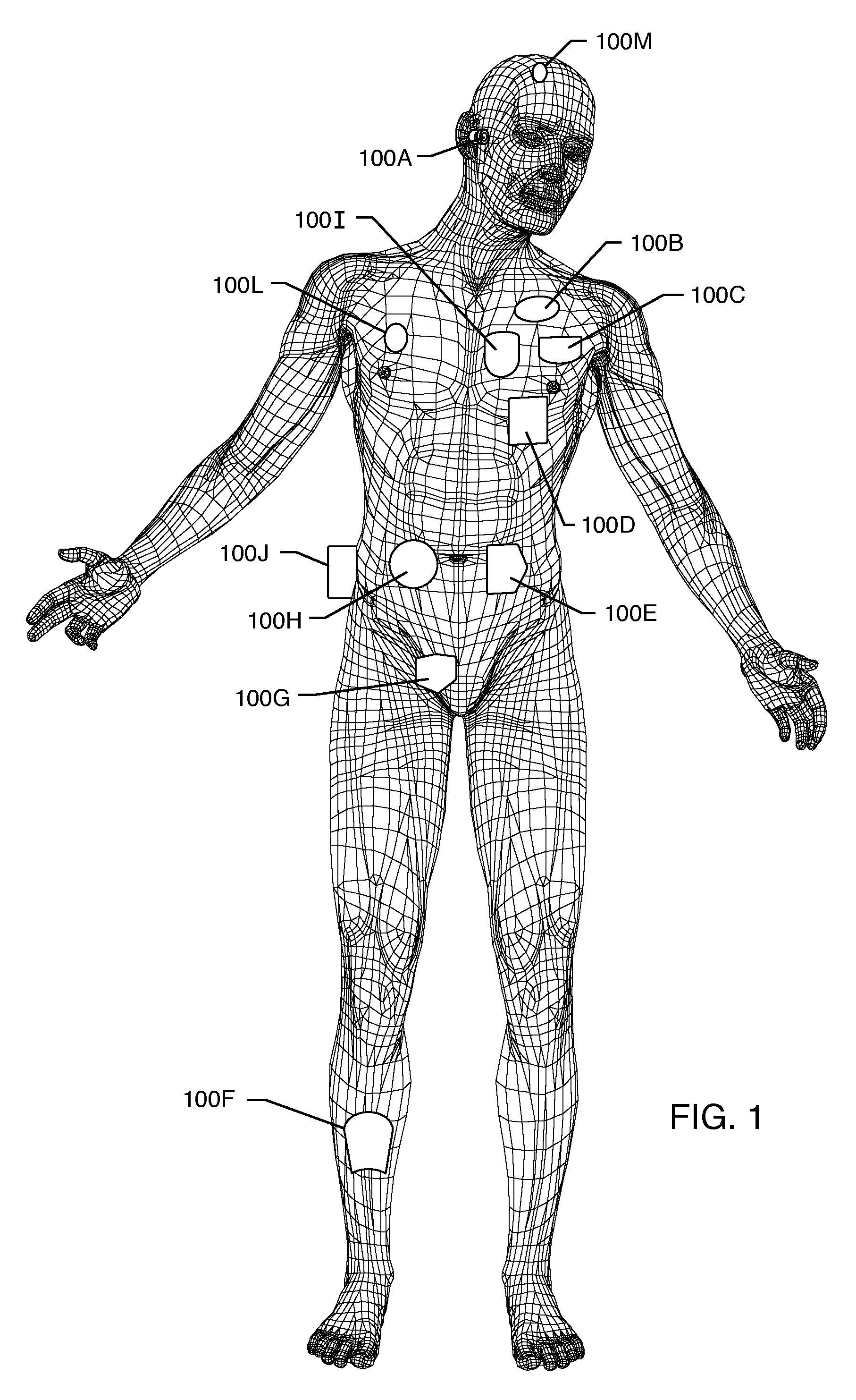 Low impedance oxide resistant grounded capacitor for an AIMD