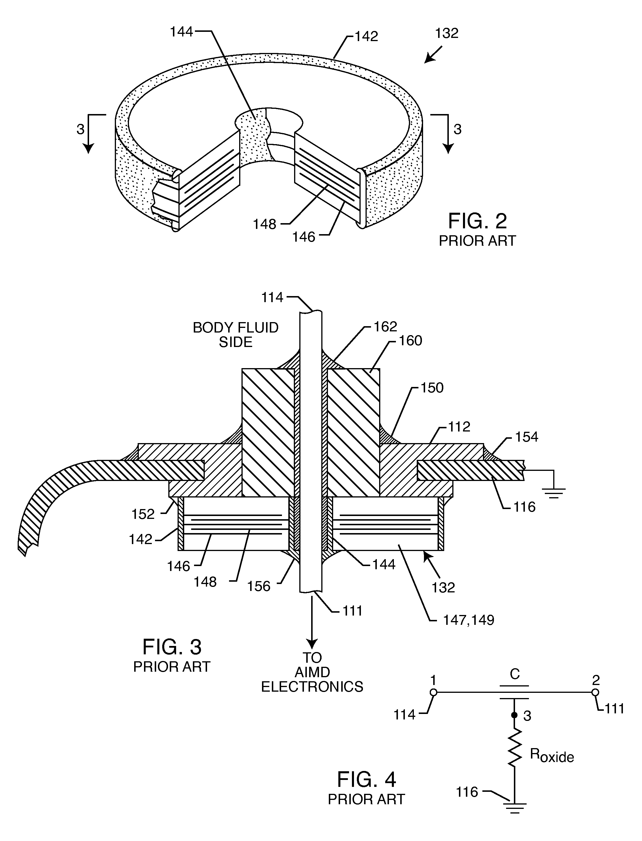 Low impedance oxide resistant grounded capacitor for an AIMD