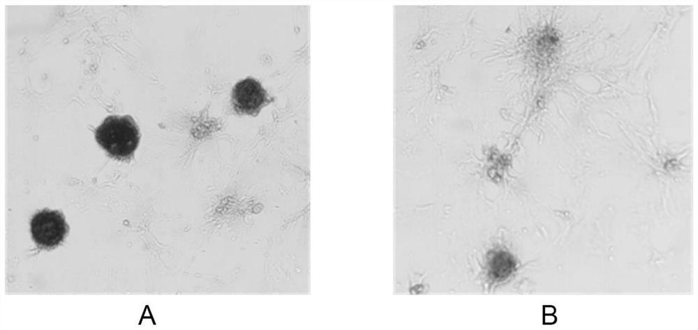 Cell culture solution for enhancing cartilage differentiation induction, method and application