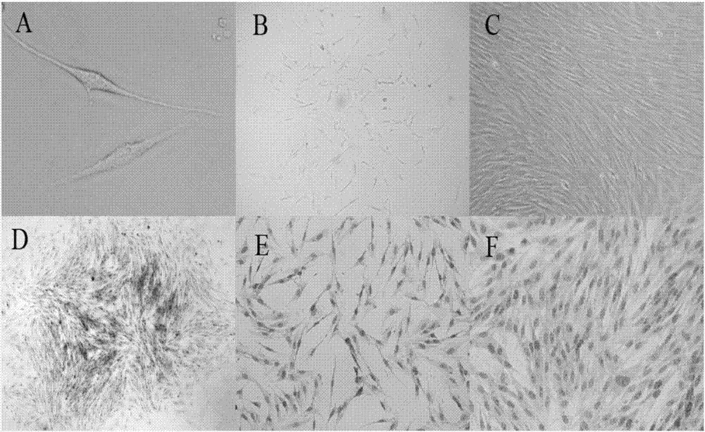 Method for separating mesenchymal stem cells from placentas and digestive enzyme composition adopted in method