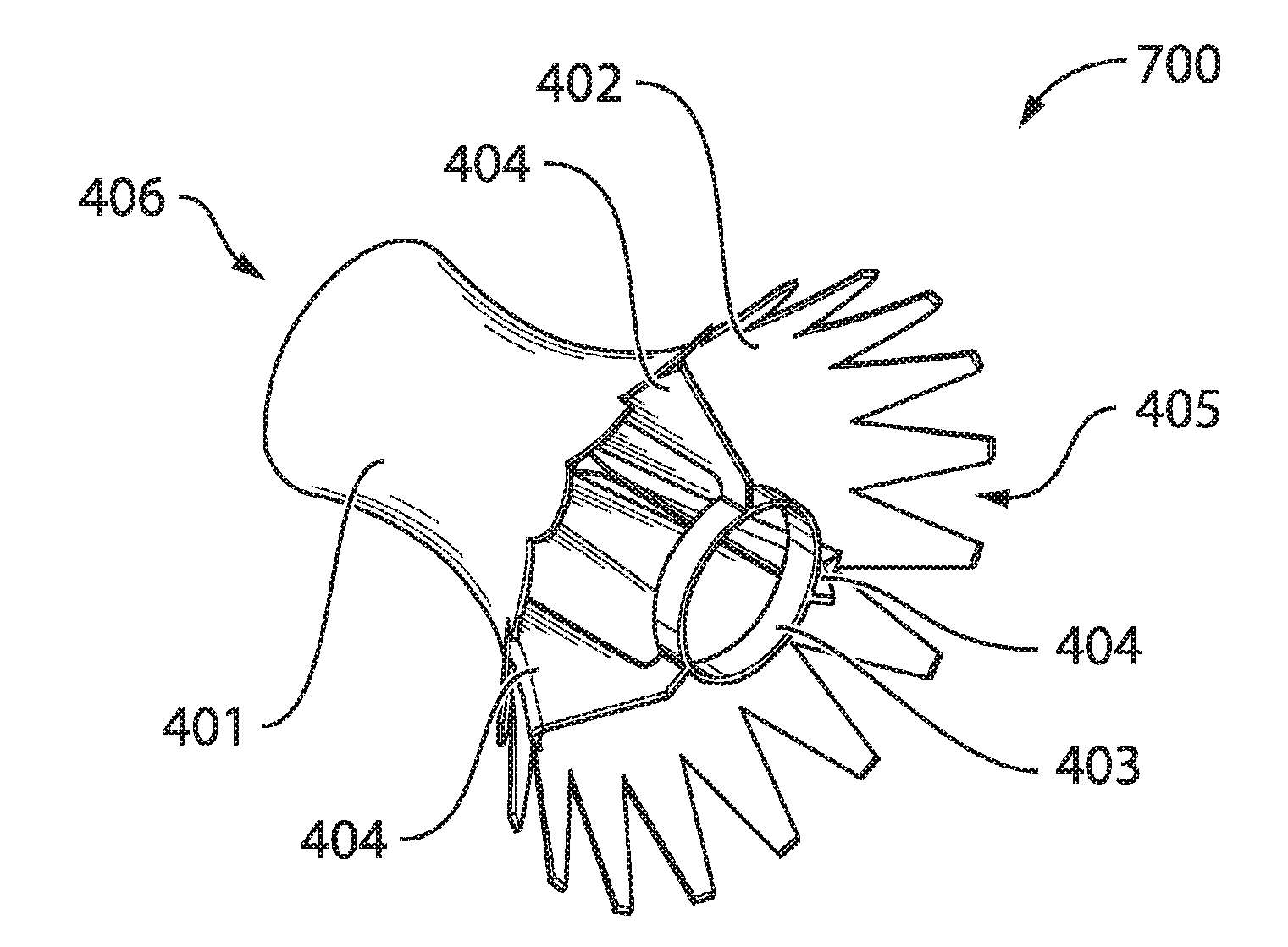 Anti-icing system for an aircraft