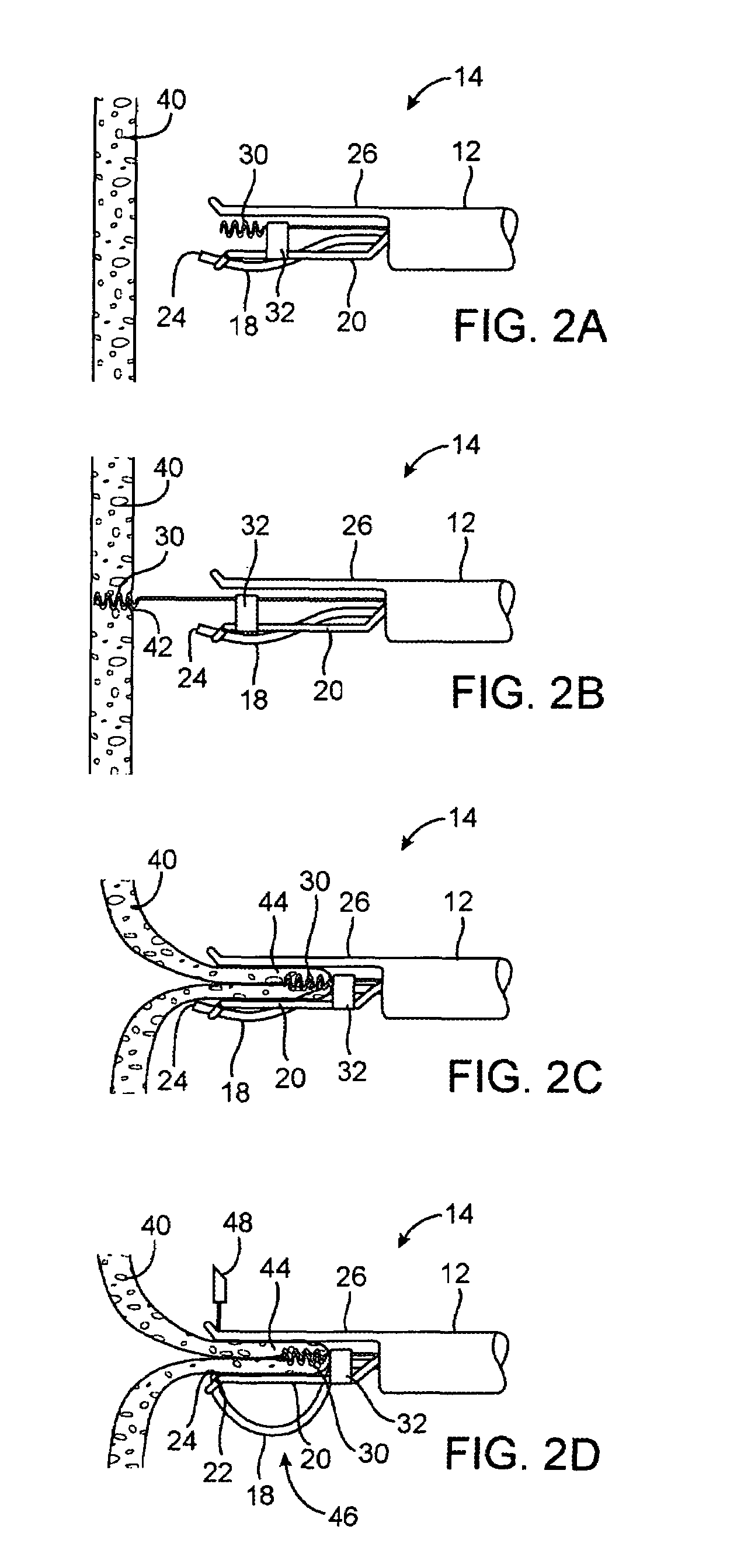 Apparatus and methods for positioning and securing anchors