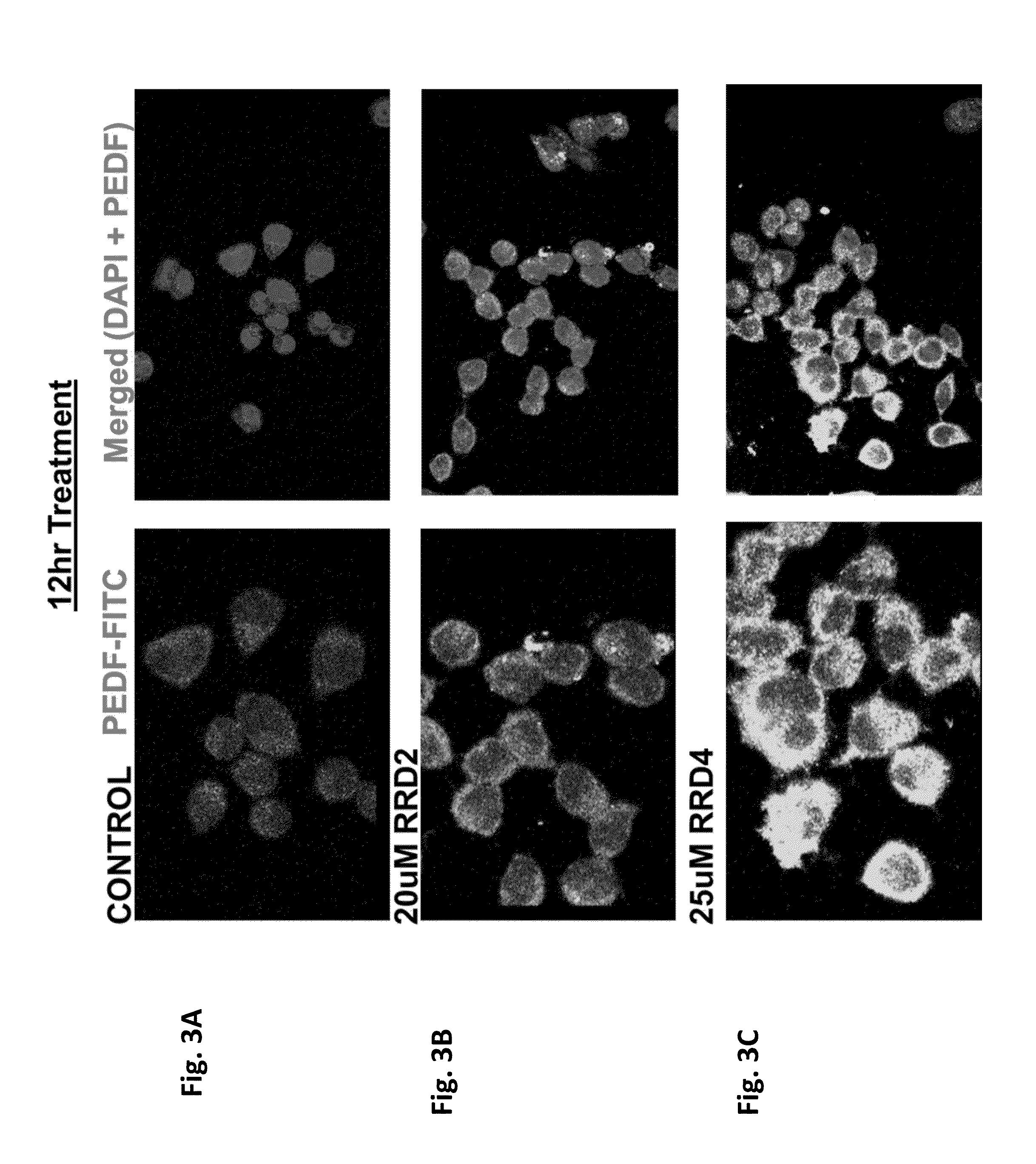 Phosphaplatins as neuroprotective agents