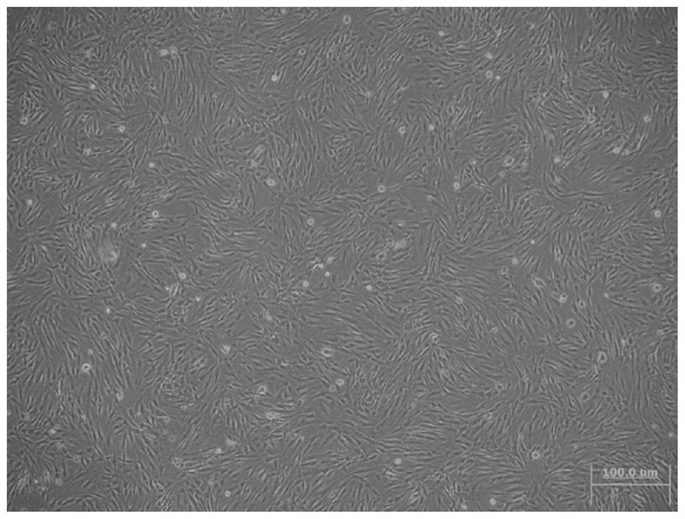 Preparation method of novel human adipose-derived stem cell preparation