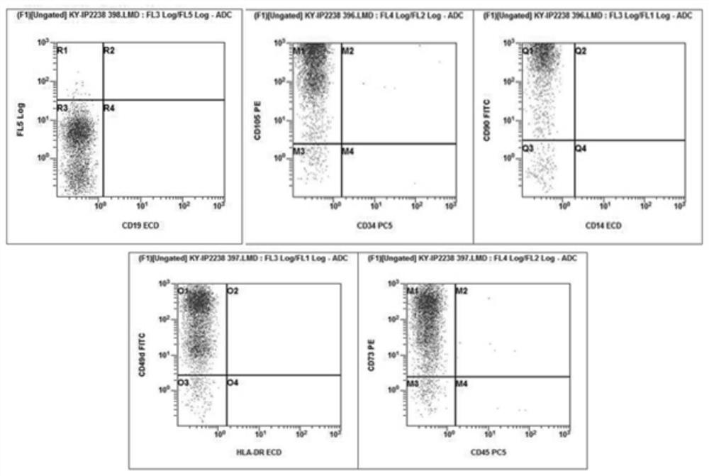 Preparation method of novel human adipose-derived stem cell preparation